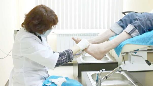 Dermatologists treat toenail fungus