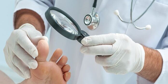 Doctors examine a fungal -infected foot