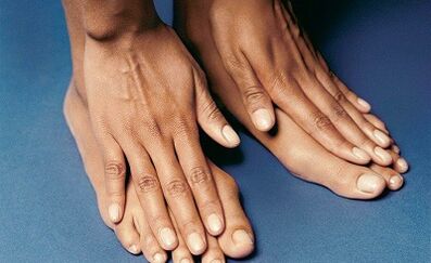 How to treat fungus in the finger