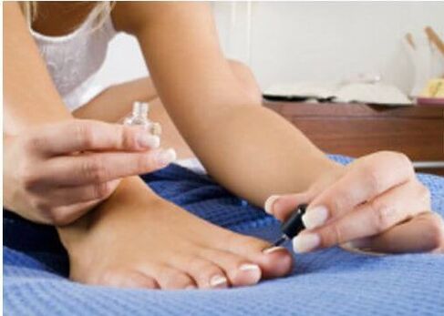 treat toenail fungus with nail polish