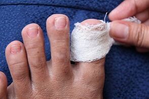 Compress for nail fungus